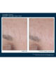 Intensive AlphaRet® Overnight Cream FACE, 30 ml