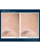 Intensive AlphaRet® Overnight Cream FACE, 30 ml