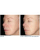 Alto Defense Serum™ FACE, 30 ml